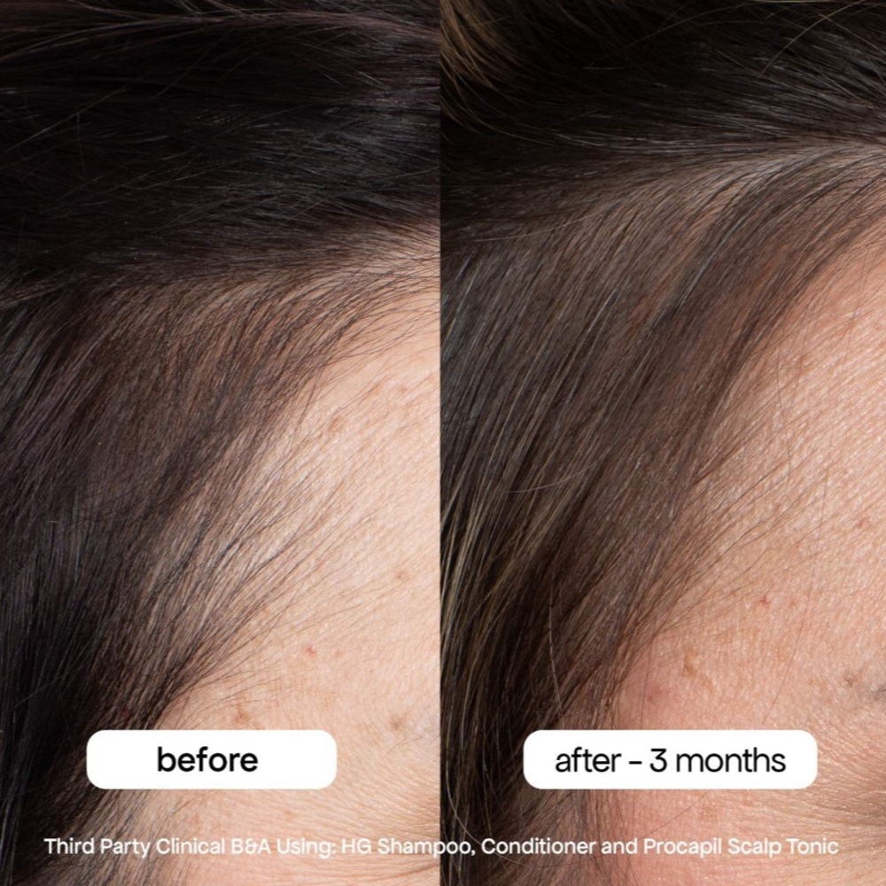 Bondi Boost HG Shampoo - White Label, Nourishing Hair Cleanse - Picture 4 of 7